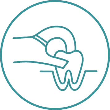 Tooth Extraction