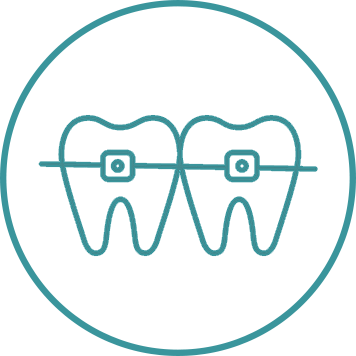 Orthodontic Surgery